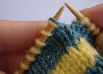 Τοποθέτηση θηλιάς topothetisi-thilias